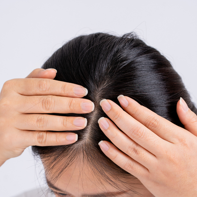 Cracking the Code to Each Unique Scalp Type with Schwarzkopf Professionals BC Bonacure Scalp Genesis
