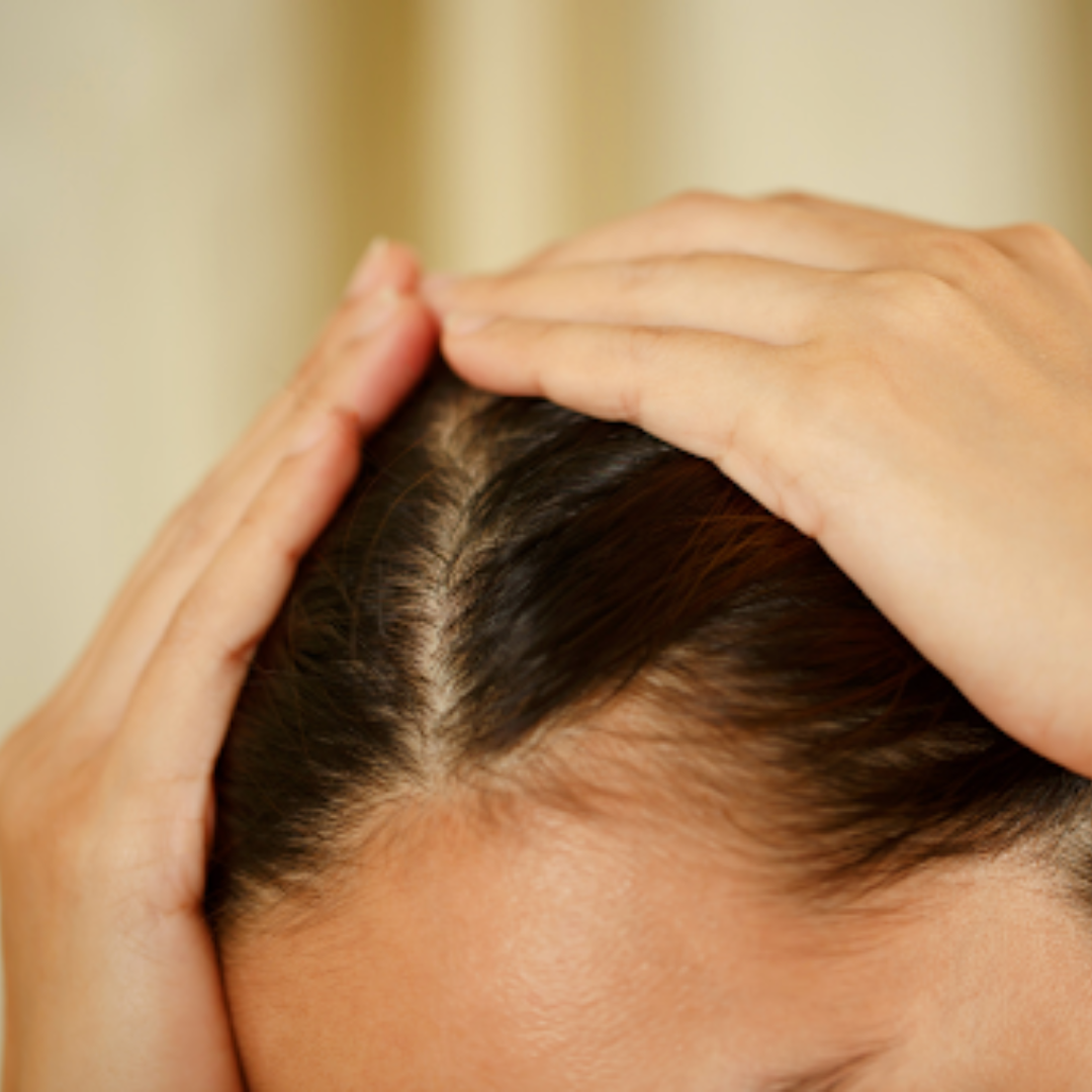 5 Causes of Oily Hair and How To Treat It HairMNL