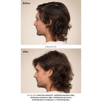 AVEDA Invati Ultra Advanced Exfoliating Shampoo Light Before and After Men Thinning - HairMNL