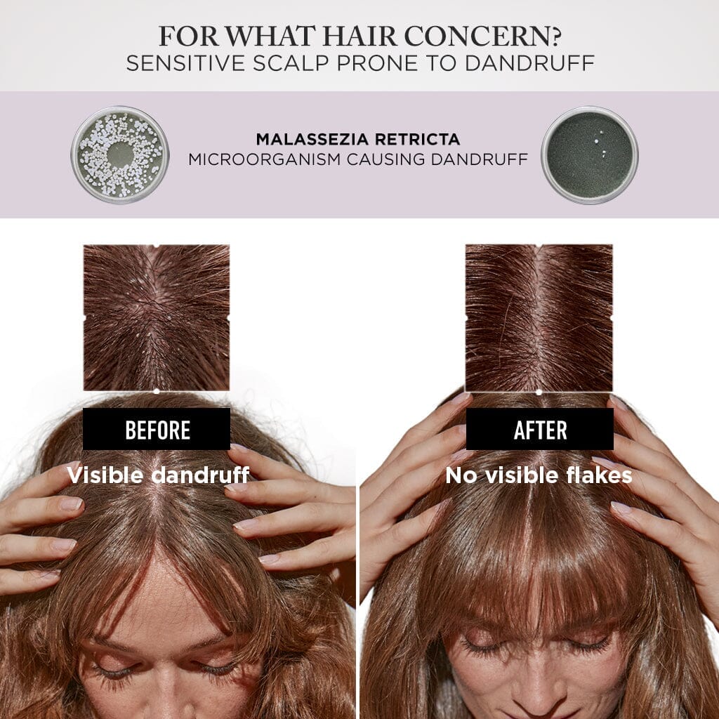 HairMNL Kérastase Symbiose Anti-Dandruff Night Serum 30ml Before and After- HairMNL