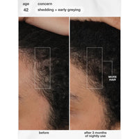 K18 Biomimetic Future IQ Hair Longevity Serum 90ml | HairMNL