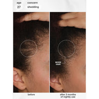 K18 Biomimetic Future IQ Hair Longevity Serum 90ml | HairMNL