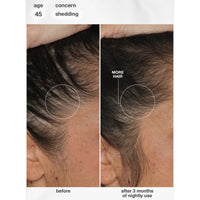 K18 Biomimetic Future IQ Hair Longevity Serum 90ml | HairMNL