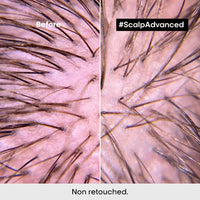 L'Oreal Serie Expert Scalp Advanced Anti-Discomfort Shampoo 500ml Scalp Care L'Oreal