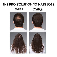 L'Oréal Professionnel Serioxyl Advanced Denser Hair Shampoo & Serum Duo 300ml Results - HairMNL