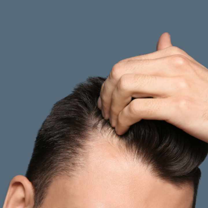 Stay Ahead Of Hair Loss from the Experts