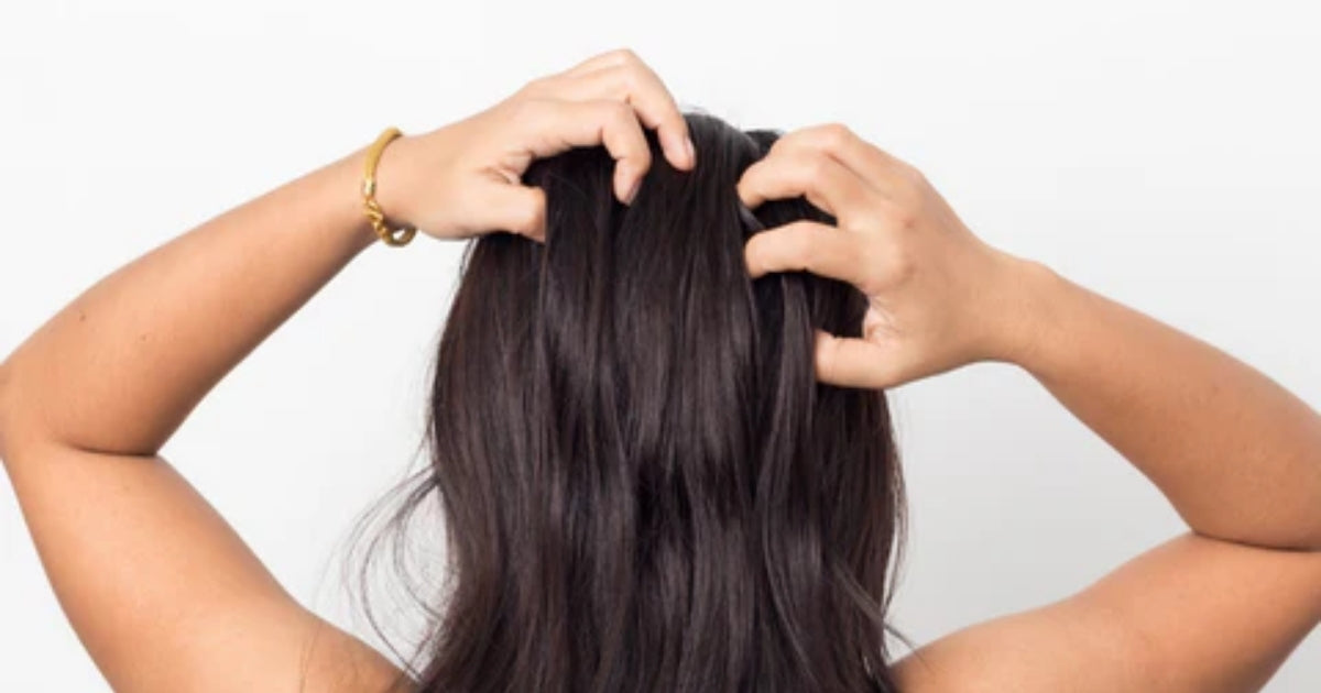An Ultimate Guide to Anti-Dandruff Shampoos in the Philippines