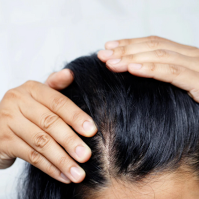 The Ultimate Guide to the Proper Scalp Care for Your Scalp Type