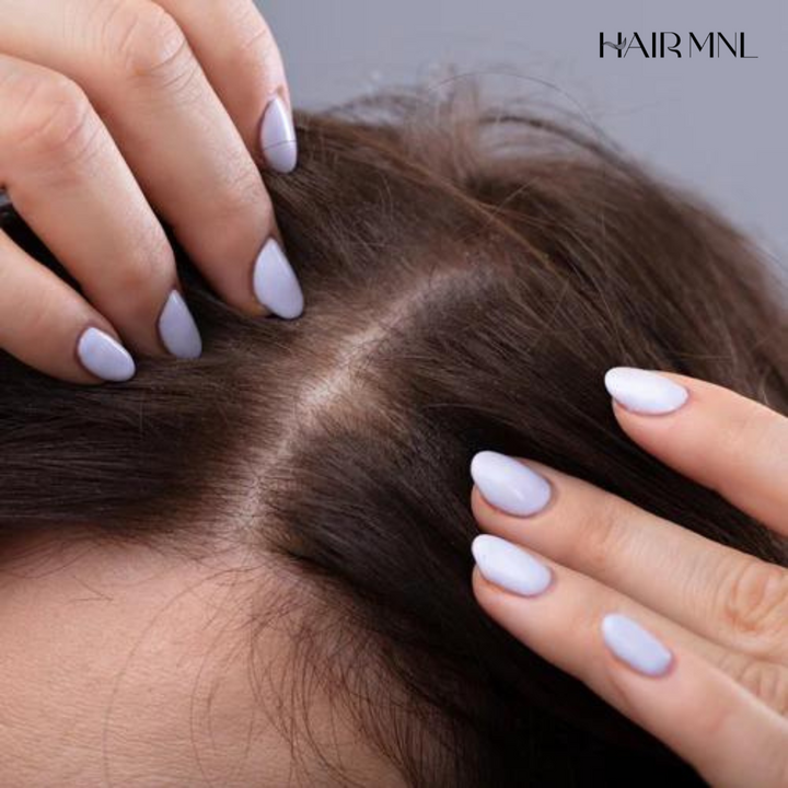 Hair Fall Woes - Why It Happens and How to Manage It