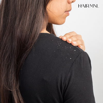 Don’t Flake Out on Your Scalp - HairMNL’s Guide to Choosing the Right Anti-Dandruff Shampoo