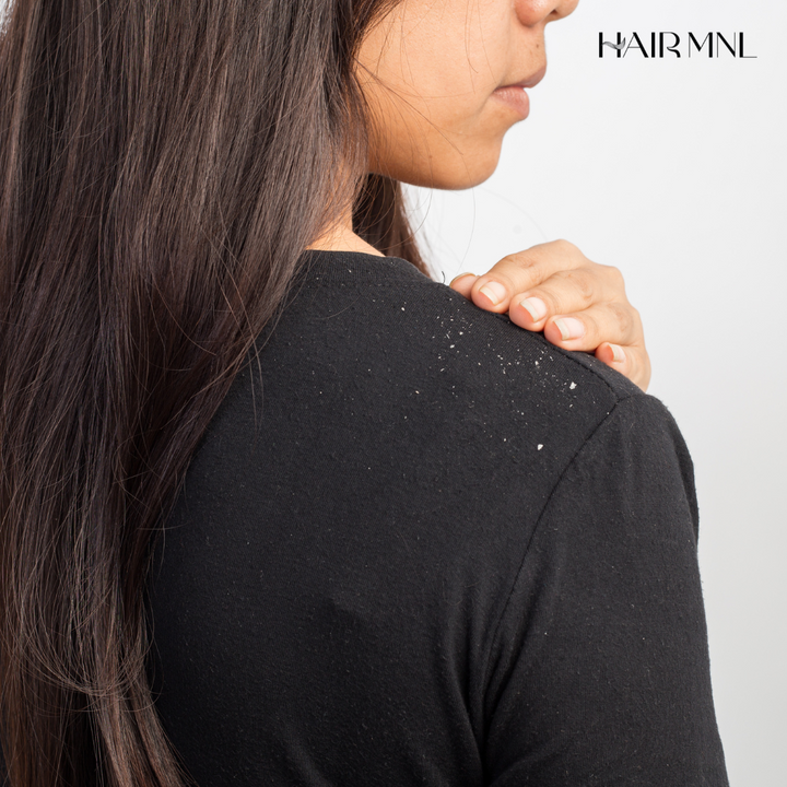 Don't Flake Out on Your Scalp - HairMNL's Guide to Choosing the Right Anti-Dandruff Shampoo