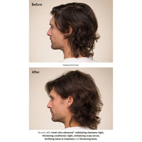 AVEDA Invati Ultra Advanced Exfoliating Shampoo Light Before and After Men Thinning - HairMNL