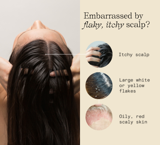 Effective Dandruff Solution: Davines Purifying & Well-Being