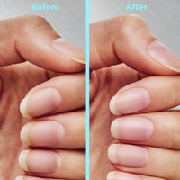 Sally Hansen Sally Hansen Repair + Rescue Insta-Smooth Ridge Filler
