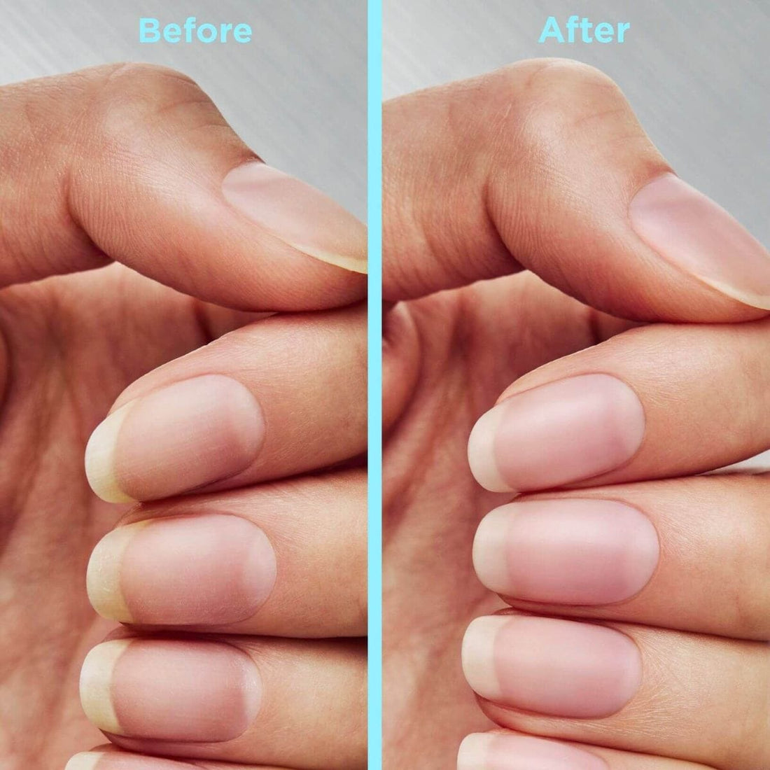 Sally Hansen Sally Hansen Repair + Rescue Insta-Smooth Ridge Filler