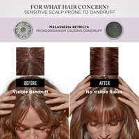 Kérastase Symbiose Anti-Dandruff Night Serum 90ml Before and After- HairMNL