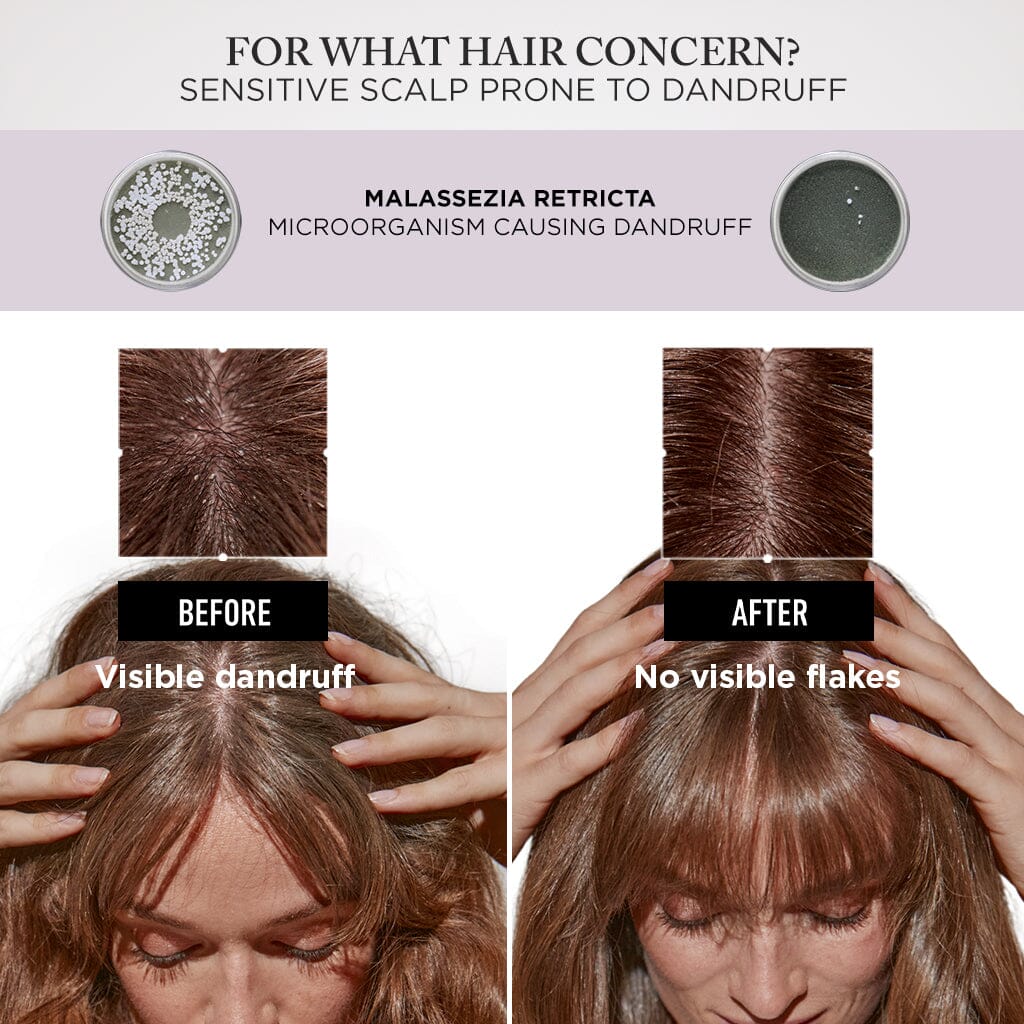 Kérastase Symbiose Anti-Dandruff Night Serum 90ml Before and After- HairMNL