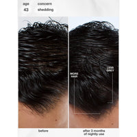 K18 Biomimetic Future IQ Hair Longevity Serum 90ml | HairMNL