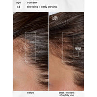 K18 Biomimetic Future IQ Hair Longevity Serum 90ml | HairMNL
