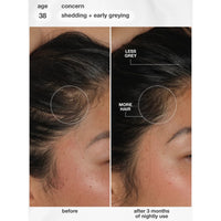 K18 Biomimetic Future IQ Hair Longevity Serum 90ml | HairMNL