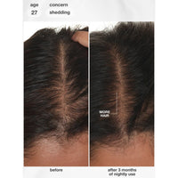 K18 Biomimetic Future IQ Hair Longevity Serum 90ml | HairMNL