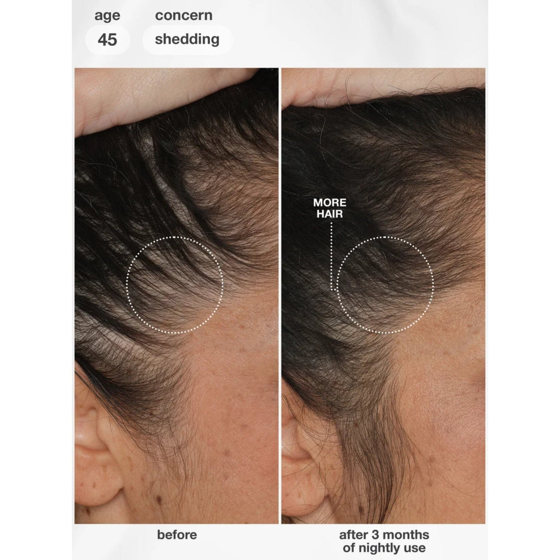 K18 Biomimetic Future IQ Hair Longevity Serum 90ml | HairMNL