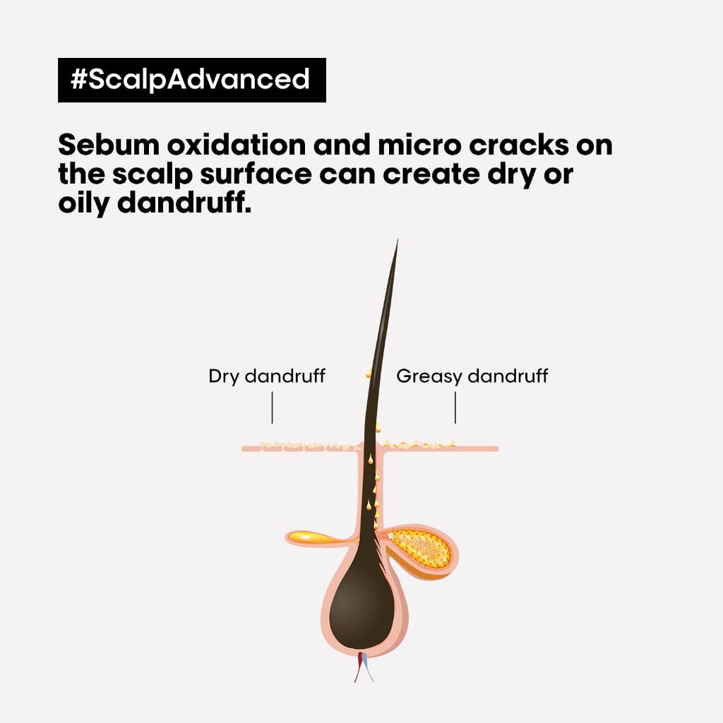 LOreal Serie Expert Scalp Advanced Anti-Dandruff Shampoo Dandruff Types