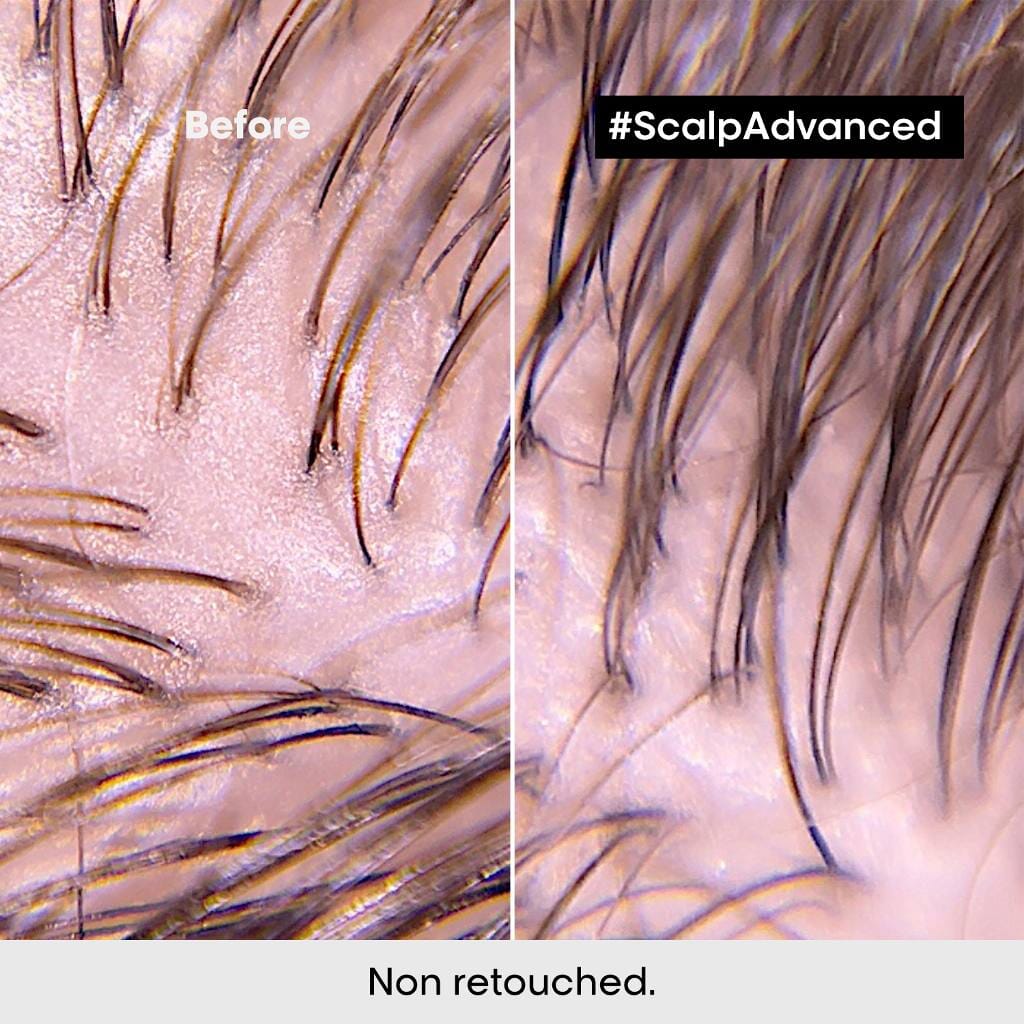 L'Oreal Serie Expert Scalp Advanced Anti-Oiliness Shampoo Scalp Care L'Oreal