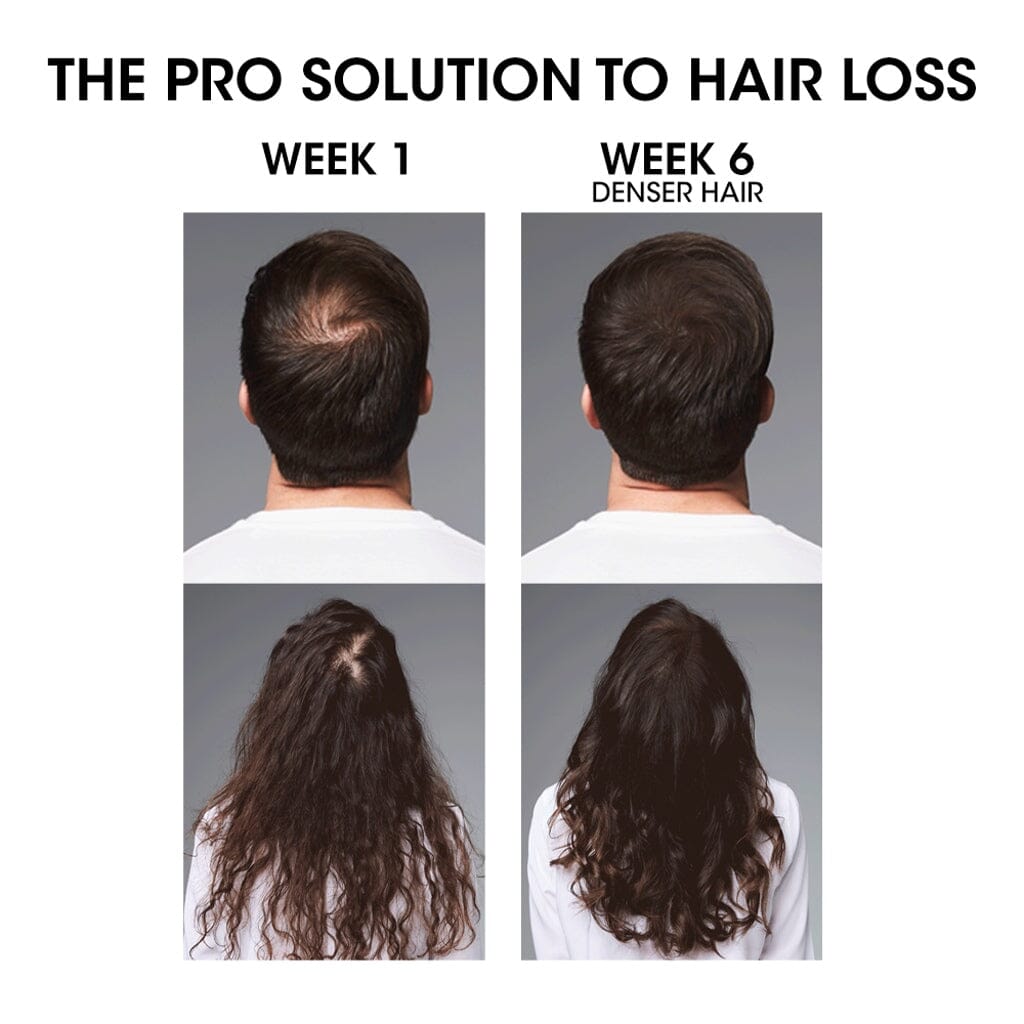 L'Oréal Professionnel Serioxyl Advanced The Pro Solution to Hair Loss